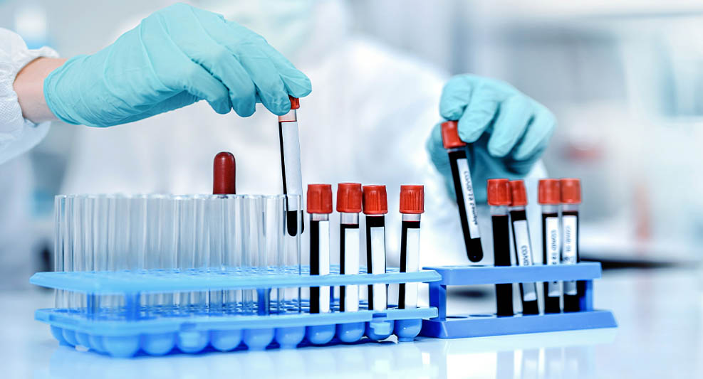 Éviter les accidents d'exposition au sang (AES) en tant qu'infirmière libérale