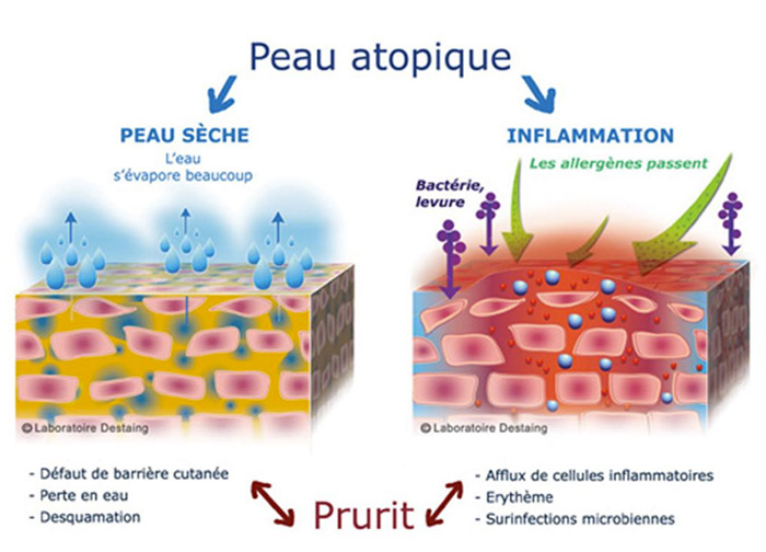 Peau atopique et prurit