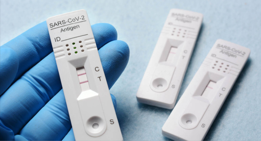 Covid-19 : la cotation des tests antigéniques IDEL et des actes de prélèvement
