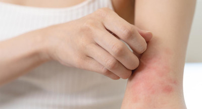 Comment réagir en cas d'allergie à un produit pendant la prise en charge d'un patient ?