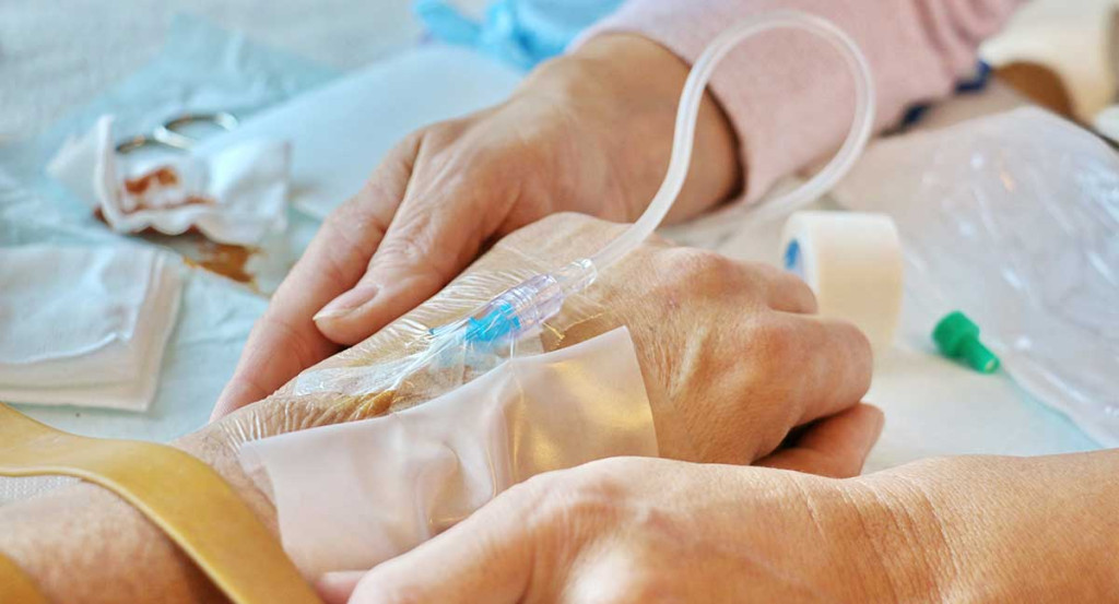 Exemple cotation perfusion sur 12h : ce que tout IDEL doit savoir