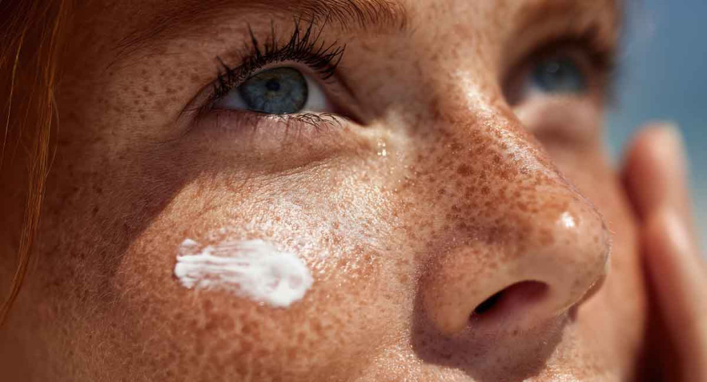 Cancer de la peau : IDEL dans la prévention le repérage des signes d’alerte
