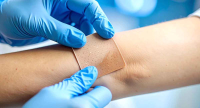 Comment utiliser un pansement hydrocolloïde en tant qu'IDEL ?