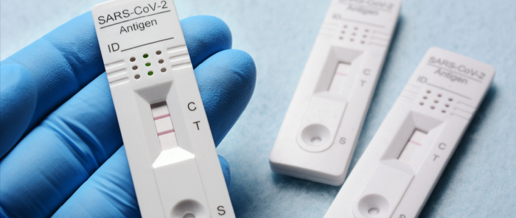 Nouvelles cotations pour la facturation de tests antigéniques