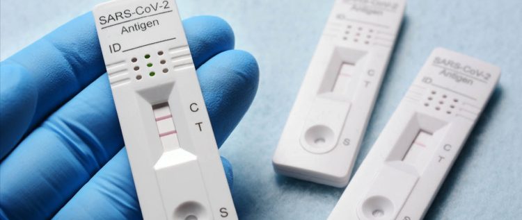 Covid-19 : la cotation du test antigenique IDEL et des actes de prélèvement